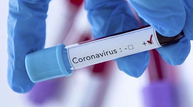 Çinli bilim insanı koronavirüs salgınının sona ereceği tarihi açıkladı