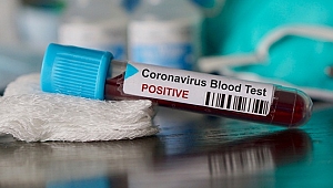 Türk bilim insanlarından sevindiren koronavirüs aşısı açıklaması