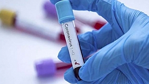 Gebze'de gazetecilere koronavirüs testi yapılacak